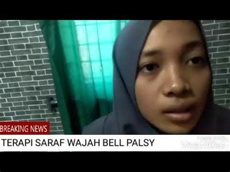 We did not find results for: Penyakit Bell palsy bisa cepat sembuh - YouTube