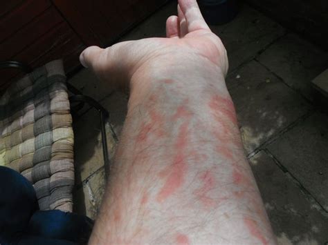 Toxic Giant Hogweed Is Spreading Thanks To Hot Weather Heres What