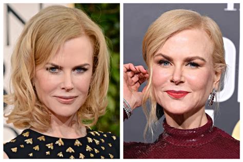 How Nicole Kidman Plastic Surgery Has Changed Her Appearance