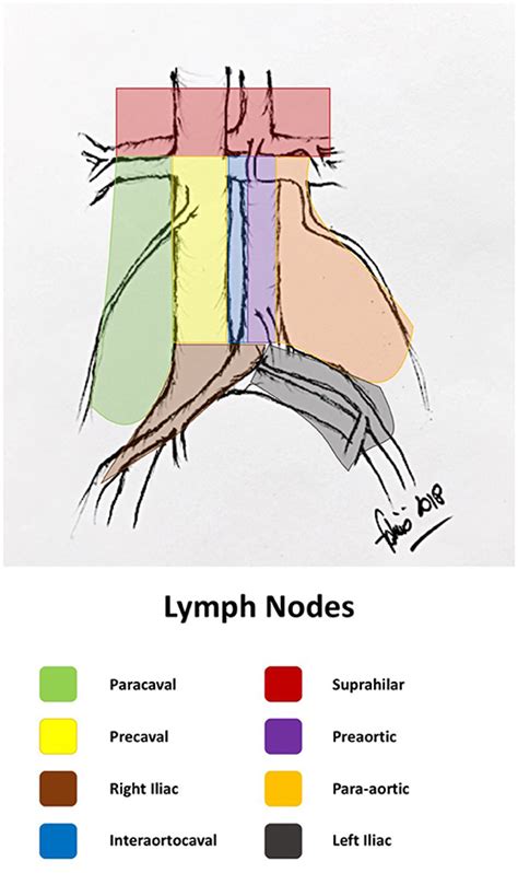 Retropectoral Lymph Nodes