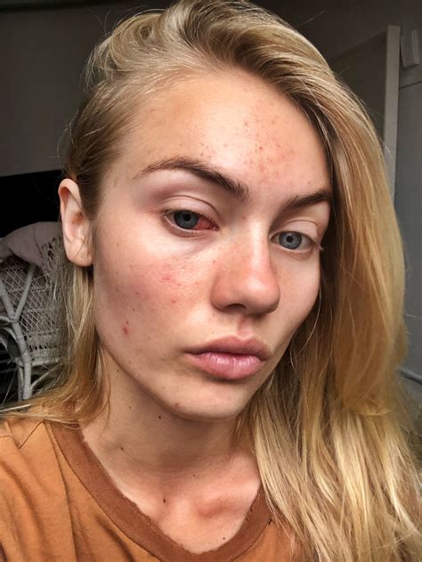 Elyse Knowles Without Makeup No Makeup Pictures Makeup Free Celebs