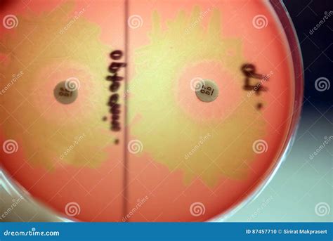 Streptococcus Pneumoniae On Blood Agar With Bacitracin And Optochin