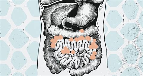 What Is Visceral Fat Causes And How To Deal With Visceral Fat