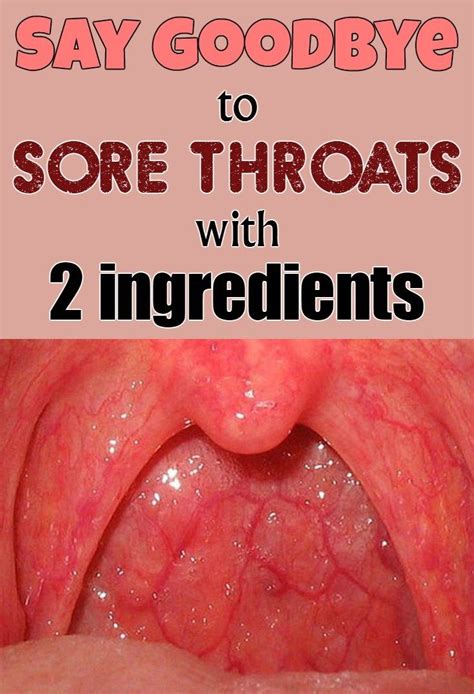 Throat Sore After Throwing Up