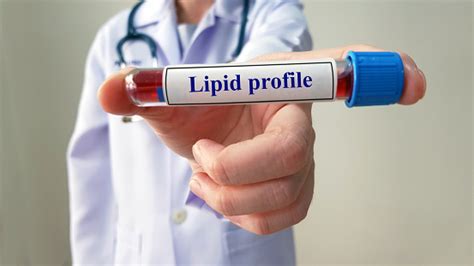 Arzt Zeigen Labor Von Lipid Profiltest Für Die Diagnose Hyperlipidämie