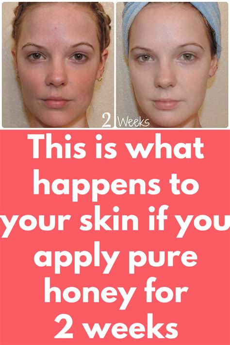 This Is What Happens To Your Skin If You Apply Pure Honey For 2 Weeks Honey Skin Benefits