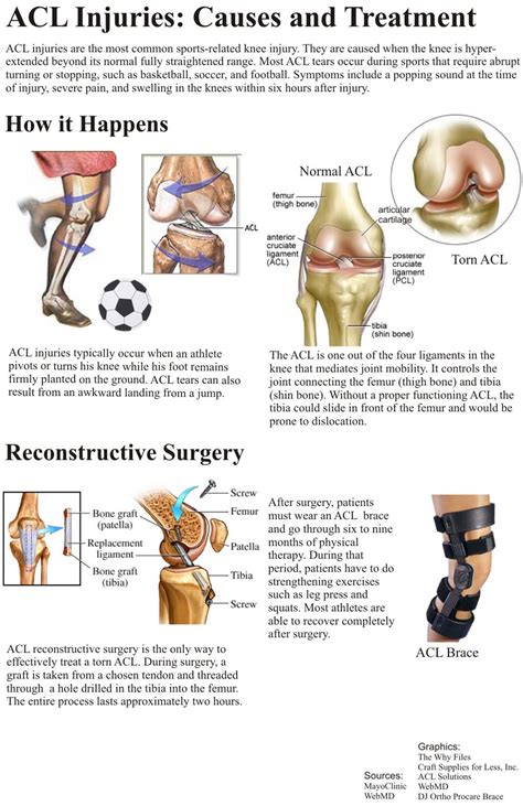 Pin By Shari Gonzales On Nursing Knee Surgery Recovery Acl Surgery