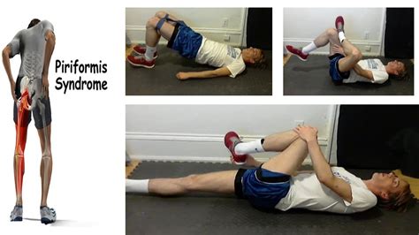 Piriformis Syndrome What Is It And How To Treat Piriformis Syndrome Exercises Youtube