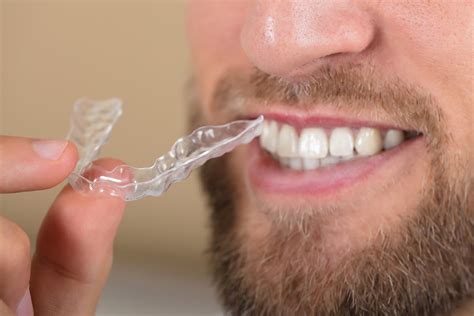 Can You Eat With Invisalign Gold Coast Smiles