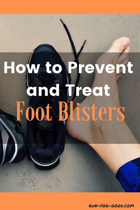 How To Prevent And Treat Foot Blisters Running Injuries Running