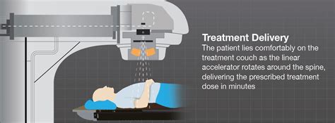 Treatment Delivery Of Radiation Therapy