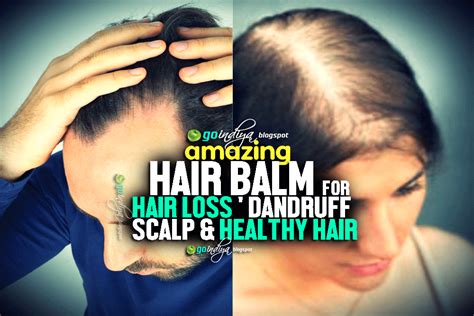 Amazing Hair Balm For Hair Loss Dandruff Scalp And Healthy Hair