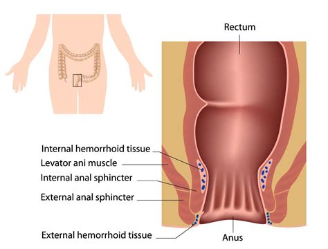 Times Human Hemorrhoid Rectum Model With Anus Human Anatomical Models
