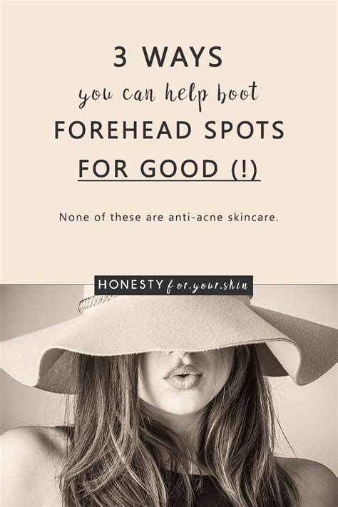 Spots On Forehead Wont Go Away Why You Have Them And How To Get Rid