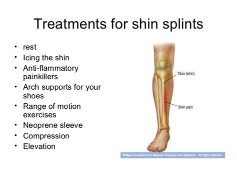 Shin Splints What They Are And How To Treat Them Nick Mccullum