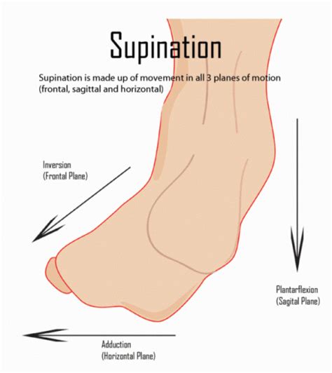 Overpronation Of Foot Bone And Spine