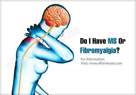 Do I Have Ms Or Fibromyalgia