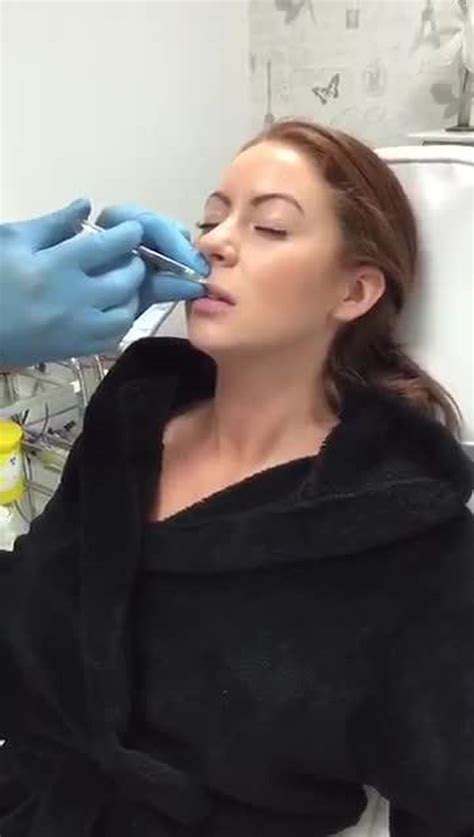 Big Brothers Laura Carter Films Herself Getting Lip Fillers After