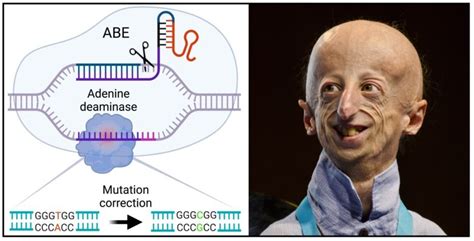 Brief Expression Of Gene Editing Tools Helped With Progeria In Mice Karolinska Institutet