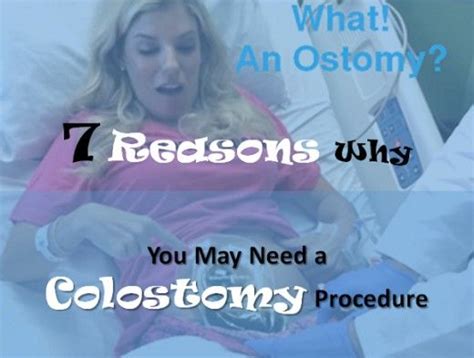Pin On Ostomates What You Need To Know If You Are A Colostomy Patient