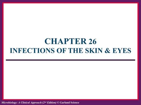 Lecture Chapter 26 Infections Of Skin And Eyes Ppt