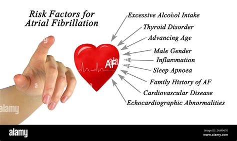 Risk Factors For Atrial Fibrillation Stock Photo Alamy