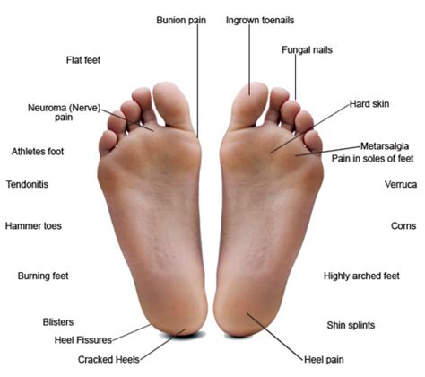 A single area of the small or large intestine can become blocked or the entire intestine may stop working. Foot Conditions - Burrard Chiropractic and Foot Orthotics