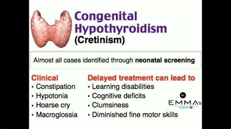 💠 Congenital Hypothyroidism Cretinism 💠 Youtube
