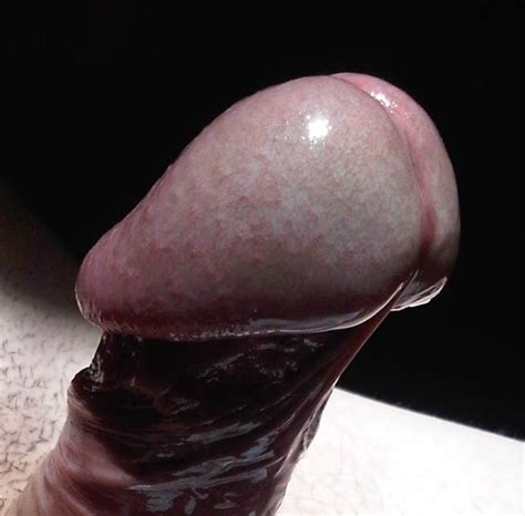 Huge Mushroom Head Cocks 85 Pics Xhamster