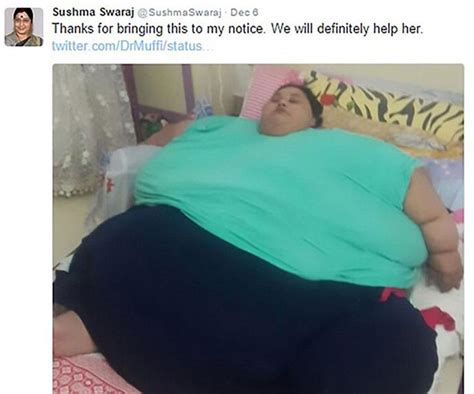 Woman Dubbed ‘worlds Fattest Woman To Get Operation Australian Womens Weekly