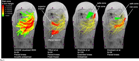 Figure 3 From The Surgical Anatomy Of The Infrapatellar Branch Of The