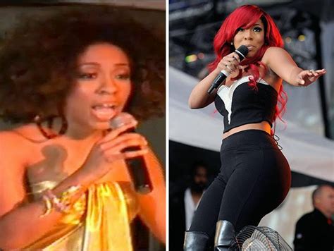 Chatter Busy K Michelle Plastic Surgery