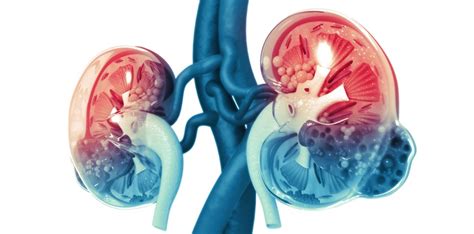 Acute Kidney Injury From Acute Tubular Necrosis Vs Prerenal Cause How