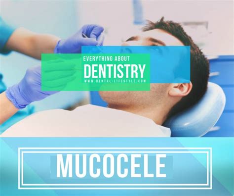 Mucocele Presentation Oral Health Tips Dental Lifestyle