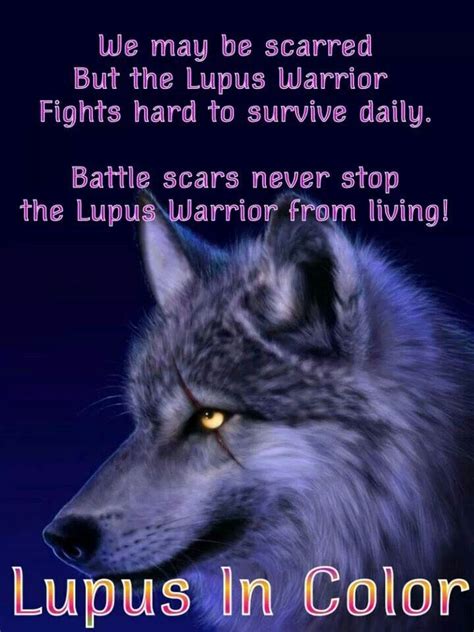 Pin By Monique Ravega On Living With Lupus Sle Ra Sjogrens Ana