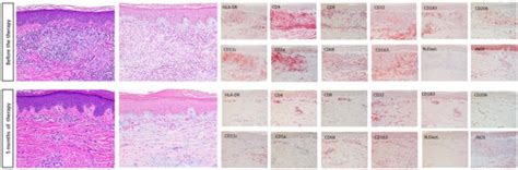 Ijms Special Issue Skin Autoimmunity And Inflammation
