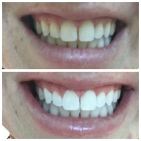 Bensalem Smiles 4 U Dental Care 1044 Byberry Rd Bensalem