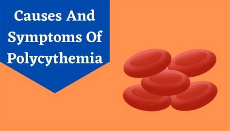 Polycythemia Vera Causes And Its Treatments