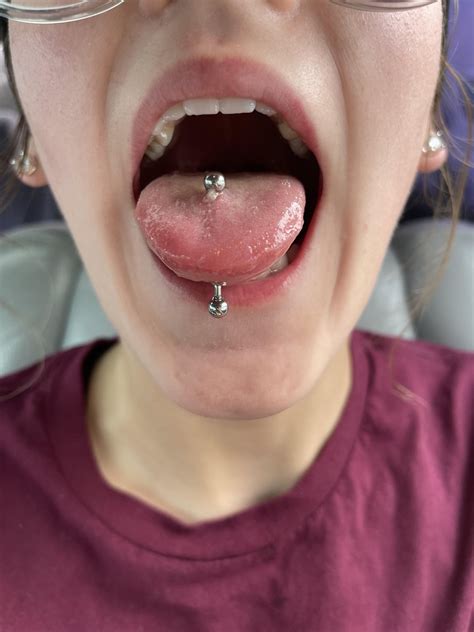 is my fresh tongue piercing infected r piercing