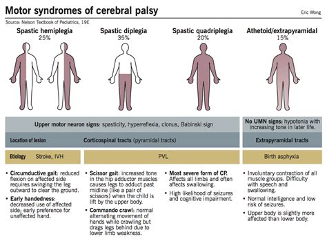 Spastic cerebral palsy is by far the most common type of overall cerebral palsy, occurring in 70% to 80% of all cases. Cerebral palsy | McMaster Pathophysiology Review