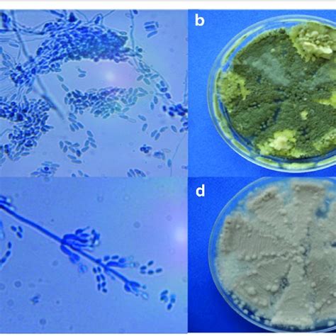 Microscopic And Macroscopic Features After Fungal Growth Of Samples