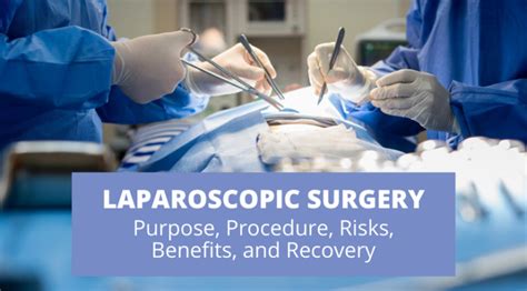 Laparoscopic Surgery Purpose Procedure Risks Benefits And Recovery