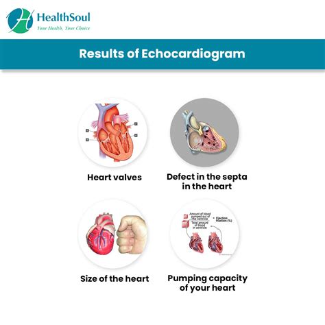 Echocardiogram Types And Indications Healthsoul