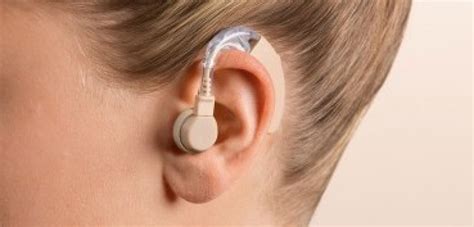 Prix des prothèse auditive audika ce qu il faut savoir