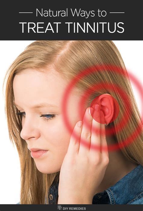 Pin On Best Tinnitus Remedies
