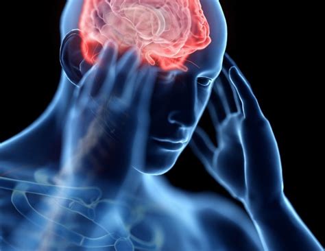Post Concussion Syndrome Car Accident Settlement