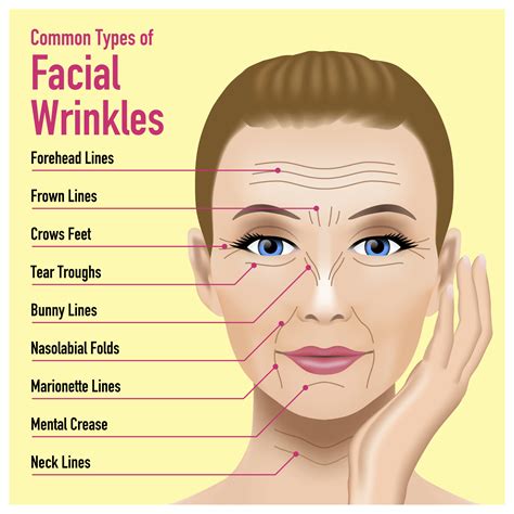 What Are Marionette Lines Facial Wrinkles Types Of Facials