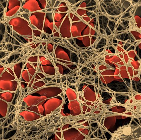 Blood Clot Stock Image C0085083 Science Photo Library
