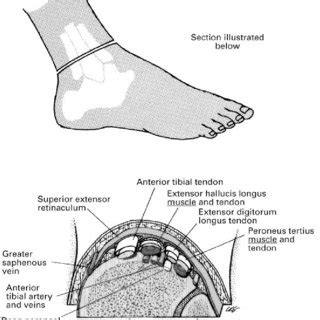 Tendon diagrams and design force vectors. Diagram showing the tendons and ligaments of the ankle and foot... | Download Scientific Diagram