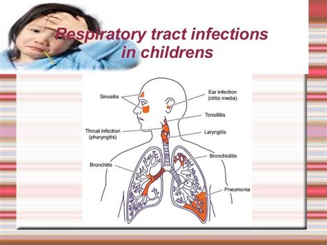 Acute Respiratory Illness In Children